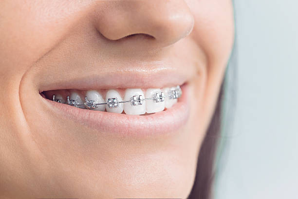 Best Veneers and Lumineers  in Addison, IL
